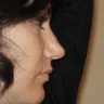 Dr Michelle Copeland - surgery nightmare - Photo 2
