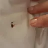 Booking.com - Bed bugs in the bed