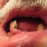 Aspen Dental - Dental service not included in original - Photo 1