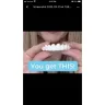 Instasmile - Painful horse teeth - 700 $ - worst experience ever!! - Photo 6