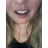 Instasmile - Painful horse teeth - 700 $ - worst experience ever!! - Photo 1