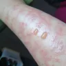 LaserAway Medical Group - Hair removal - Photo 7