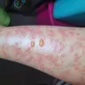 LaserAway Medical Group - Hair removal - Photo 2