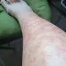 LaserAway Medical Group - Hair removal - Photo 1