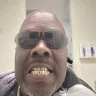 Coast Dental Services - 2 gold crowns snatched from my mouth - Photo 3
