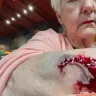 Fuddruckers / Luby's Fuddruckers Restaurants - Hospital emergency bill - Photo 5