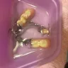 Aspen Dental - Loose partials, and now a bill for x rays they didn't file - Photo 1