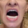 Aspen Dental - Implants and dentures - Photo 1