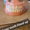 Aspen Dental - Implants and dentures - Photo 3