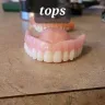 Aspen Dental - Implants and dentures - Photo 8