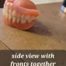 Aspen Dental - Implants and dentures - Photo 5
