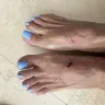 Saks Fifth Avenue - Ill fitting sandal that caused bleeding blisters - Photo 3