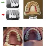 Grandville Dental Health Center PC - Full mouth restoration - dental crowns & bridges - Photo 2
