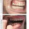 Grandville Dental Health Center PC - Full mouth restoration - dental crowns & bridges - Photo 3