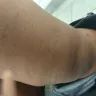 Burger King - I slip and fell in the ladies restroom - Photo 2