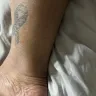 Riu Republica Hotel Adults Only - Bed bug bites