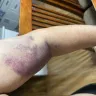 BioLife Plasma Services - Its a Circus