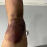 BioLife Plasma Services - Its a Circus