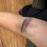 BioLife Plasma Services - Its a Circus