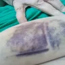Advocate Christ Hospital - Dr. did not order medication in timely fashion