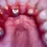 Nuvia Dental Implant Center - Non completion of service. No itemized invoice - Photo 1