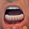 Nuvia Dental Implant Center - Non completion of service. No itemized invoice - Photo 2