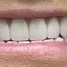 Nuvia Dental Implant Center - Worth It! - Photo 1