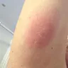 Travelodge - Bed bugs at travelodge rochester - Photo 5