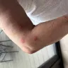 Travelodge - Bed bugs at travelodge rochester - Photo 6