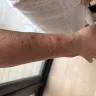 Travelodge - Bed bugs at travelodge rochester - Photo 8