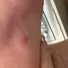 Travelodge - Bed bugs at travelodge rochester - Photo 1
