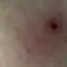 Travelodge - Bed bugs at travelodge rochester - Photo 3