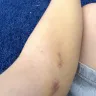 American Red Cross - Donating plasma  - Photo 3