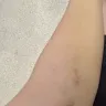 American Red Cross - Donating plasma  - Photo 1
