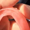 Aspen Dental - Dentures - Photo 2
