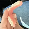 Aspen Dental - Dentures - Photo 3