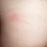 Levin Furniture - bed bugs in [protected]@box spring - Photo 1