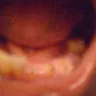 Western Dental Services - bad & un-needed dental work - Photo 1