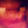 Western Dental Services - bad & un-needed dental work - Photo 3