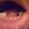 Western Dental Services - bad & un-needed dental work - Photo 4