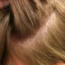 Empire Beauty School - chemical burn scalp - Photo 3