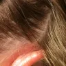 Empire Beauty School - chemical burn scalp - Photo 4