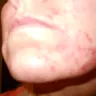 NuBrilliance - Damage to face - Photo 2