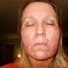NuBrilliance - Damage to face - Photo 4