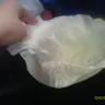 Huggies - stitching and soreness - Photo 1
