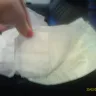 Huggies - stitching and soreness - Photo 3