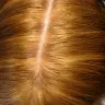 SmartStyle - terribly burning scalp/ horrible foil job