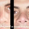 Dr. Paul Nassif, Paul Nassif, Spalding Drive Cosmetic Surgery & Dermatology - Paul Nassif gave me Poor results, Poor service, and Financially exploited me - Photo 1