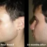 Dr. Paul Nassif, Paul Nassif, Spalding Drive Cosmetic Surgery & Dermatology - Paul Nassif gave me Poor results, Poor service, and Financially exploited me - Photo 2