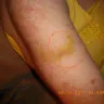 Zellers - Instore Injury - Photo 1